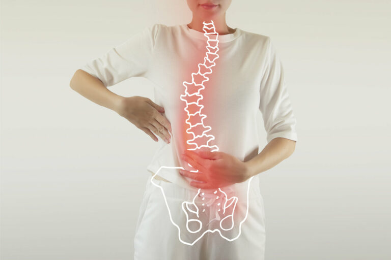 physiotherapy for posture correction rutherford, edmonton south