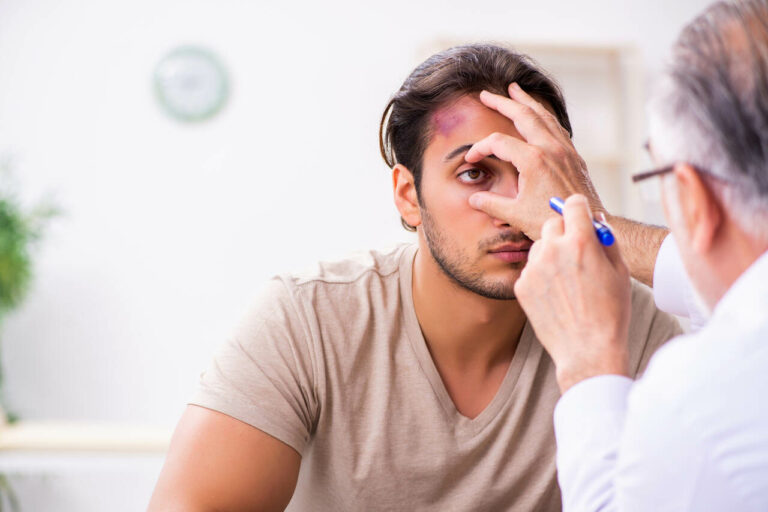 concussion causes